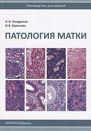 Патология матки Руководство для врачей (2 изд.) (м) Кондриков — 2684407 — 1