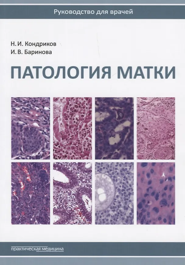 Книга Патология матки Руководство для врачей (2 изд.) (м) Кондриков () — 1