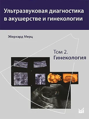 Книга Ультразвуковая диагностика в акушерстве и гинекологии.т.2 (Эберхард Мерц)