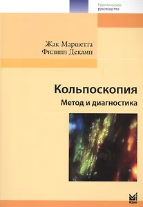 Кольпоскопия
