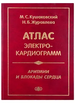 Атлас электрокардиограмм. Аритмии и блокады сердца