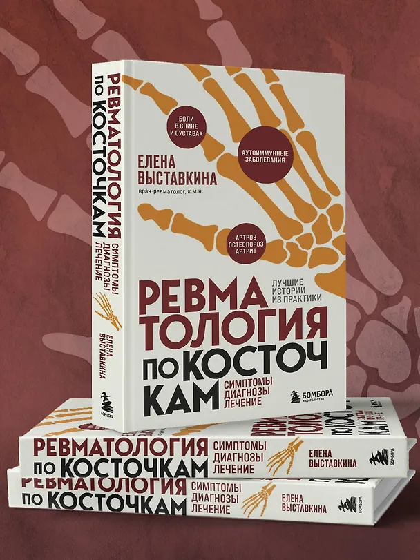 Книга Ревматология по косточкам. Симптомы, диагнозы, лечение (Елена Выставкина) — 10