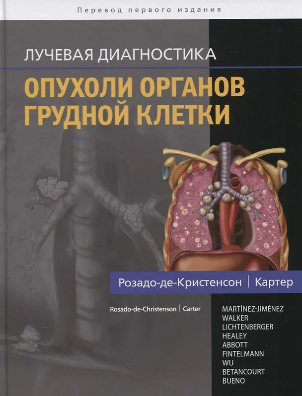 Книга Лучевая диагностика. Опухоли органов грудной клетки () — 1