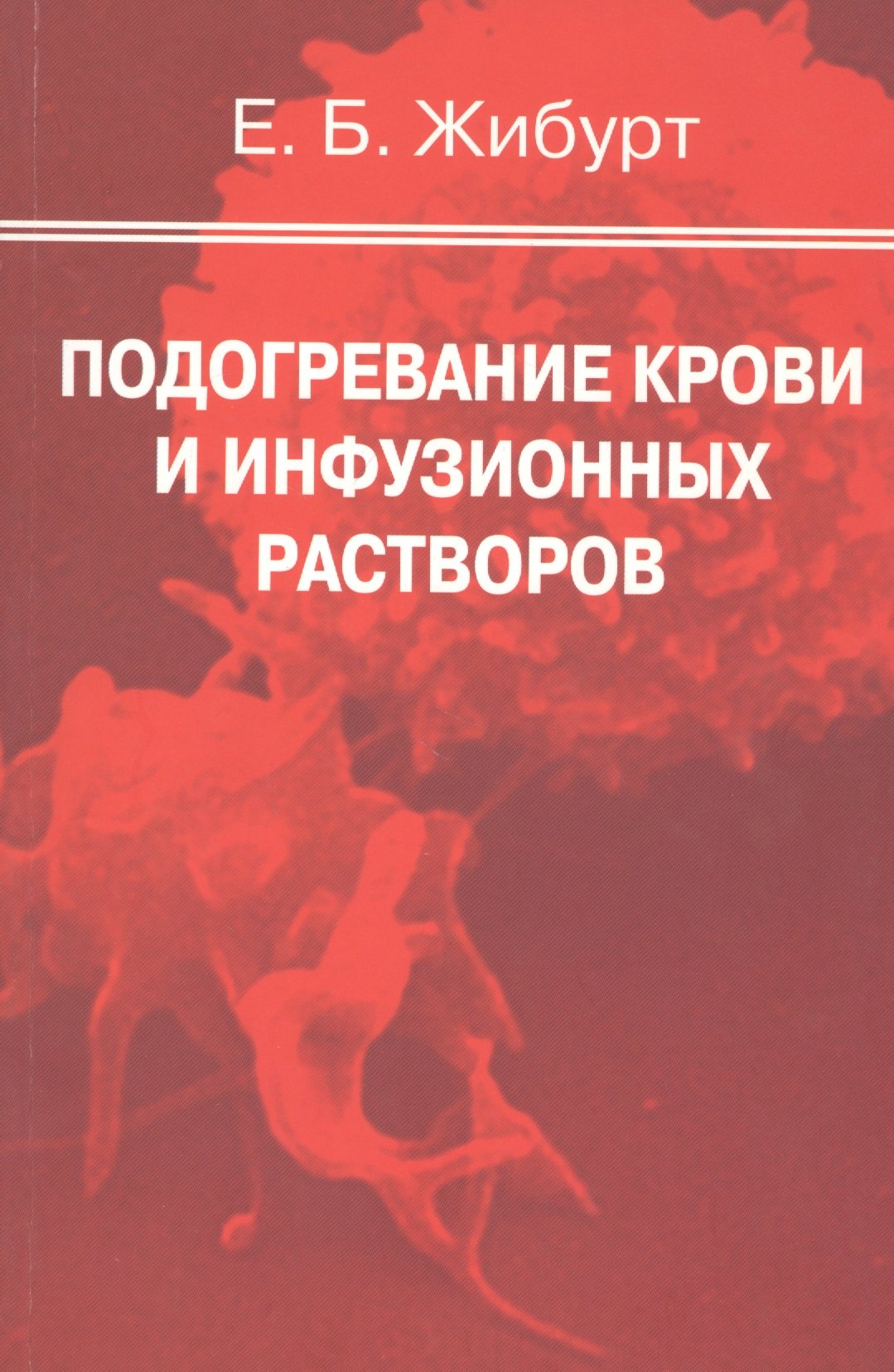 

Подогревание крови и инфузионных растворов. Руководство для врачей