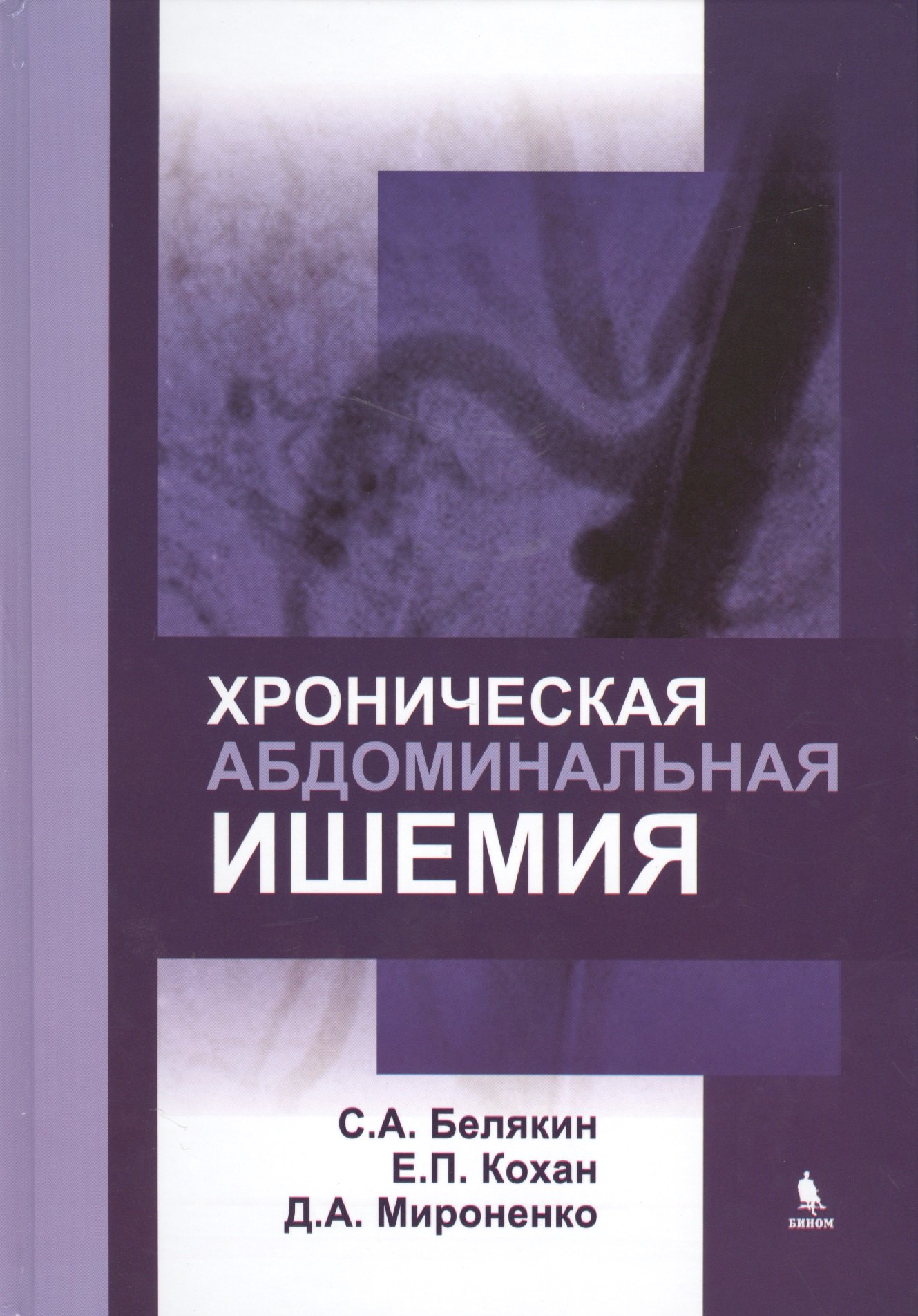 

Хроническая абдоминальная ишемия: монография