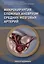 Микрохирургия сложных аневризм средних мозговых артерий: крупных, гигантских, фузиформных и частично тромбированных — 3111929 — 1