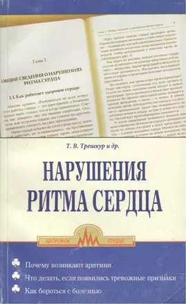 Нарушение ритма сердца — 2116671 — 1