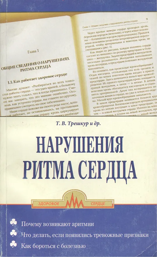 Книга Нарушение ритма сердца () — 1