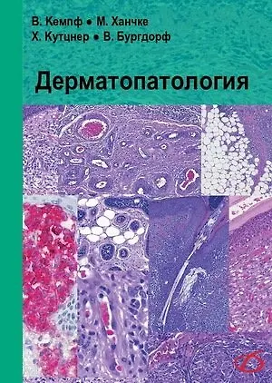 Книга Дерматопатология () — 1