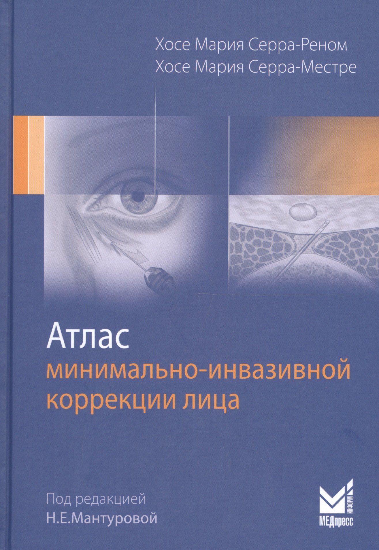 

Атлас минимально-инвазивной коррекции лица. Омоложение лица объемным липофилингом