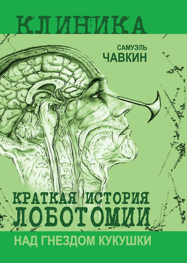 Книга Над гнездом кукушки. Краткая история лоботомии (Самуэль Чавкин) — 1