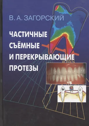 Книга Частичные съемные и перекрывающие протезы. Морфология и ультраструктура ()