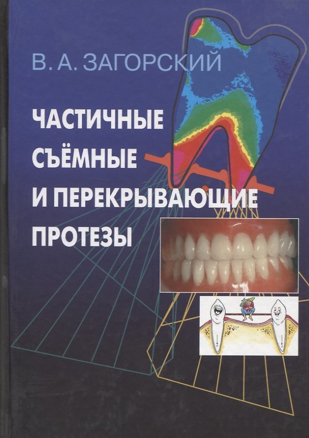 Книга Частичные съемные и перекрывающие протезы. Морфология и ультраструктура () — 1
