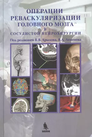 Операции реваскуляризации головного мозга в сосудистой нейрохирургии, цв. илл. — 2462226 — 1