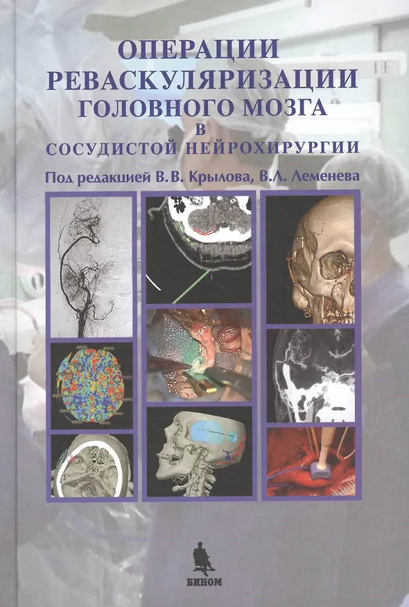 Книга Операции реваскуляризации головного мозга в сосудистой нейрохирургии, цв. илл. () — 1