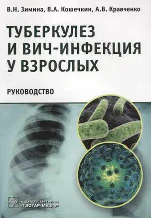 Туберкулез и ВИЧ-инфекция у взрослых. Руководство — 2638284 — 1