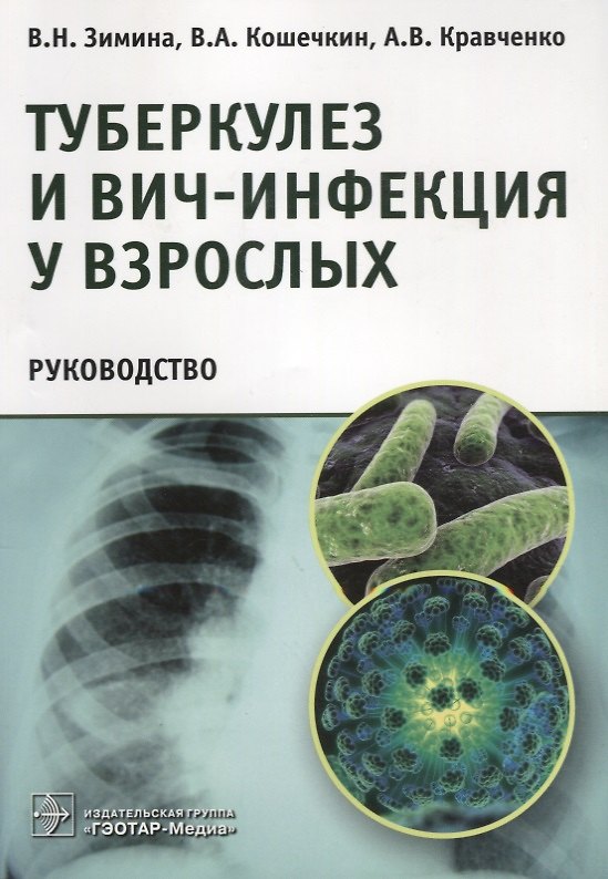 Книга Туберкулез и ВИЧ-инфекция у взрослых. Руководство (Вера Зимина) — 1