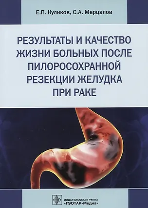 Книга Результаты и качество жизни больных после пилоросохранной резекции желудка при раке ()