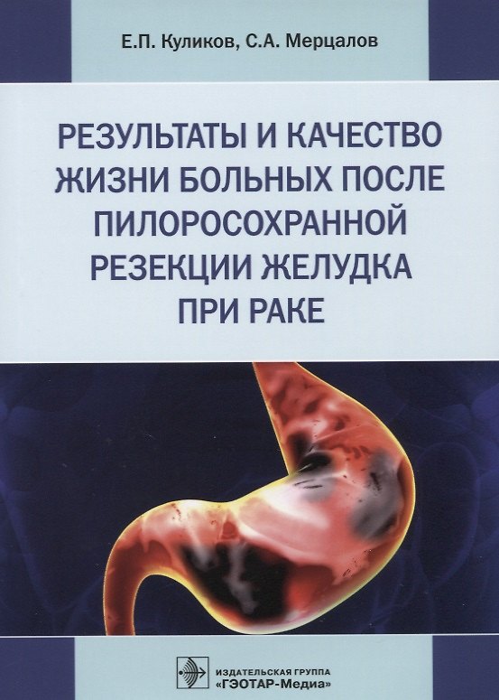 Книга Результаты и качество жизни больных после пилоросохранной резекции желудка при раке () — 1