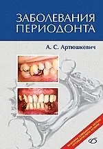 Книга Заболевания периодонта (Александр Артюшкевич) — 1