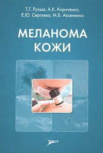 Меланома кожи