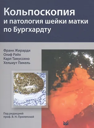 Книга Кольпоскопия и патология шейки матки по Бургхардту (Франк Жирарди)