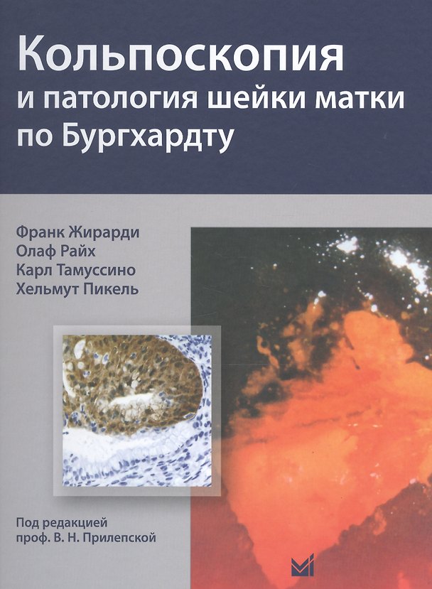 Книга Кольпоскопия и патология шейки матки по Бургхардту (Франк Жирарди) — 1