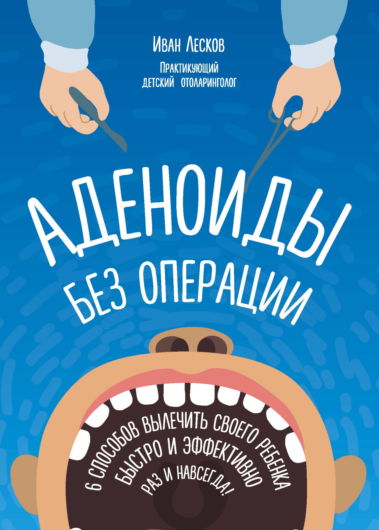 

Аденоиды без операции