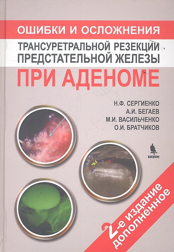 Книга Ошибки и осложнения трансуретральной резекции предстательной железы при аденоме. 2 -е изд.доп. (Нина Сергиенко) — 1