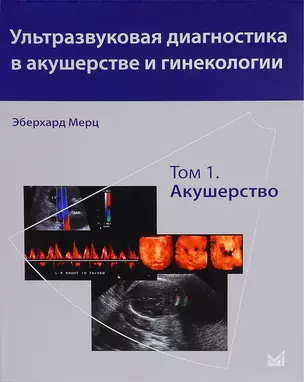 Ультразвуковая диагностика в акушерстве и гинекологии. Т.1. Акушерство — 2679080 — 1