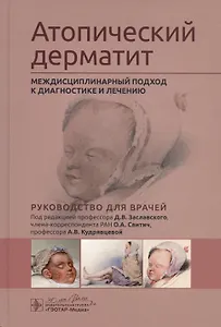 Атопический дерматит. Междисциплинарный подход к диагностике и лечению. Руководство для врачей