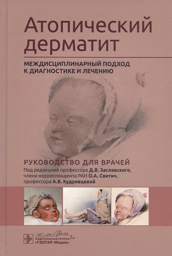 Книга Атопический дерматит. Междисциплинарный подход к диагностике и лечению. Руководство для врачей (А.В. Кудрявцева, Д. Заславский, О. Свитич) — 1