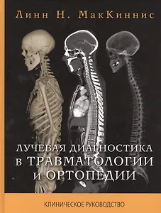Лучевая диагностика в травматологии и ортопедии