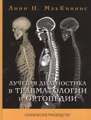 Лучевая диагностика в травматологии и ортопедии — 2525206 — 1