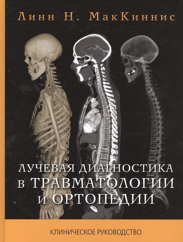 Книга Лучевая диагностика в травматологии и ортопедии () — 1