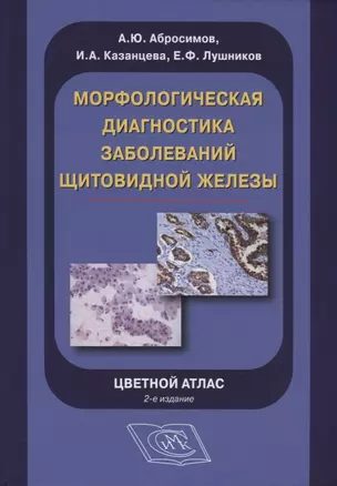 Морфологическая диагностика заболеваний щитовидной железы. Цветной атлас — 2762856 — 1