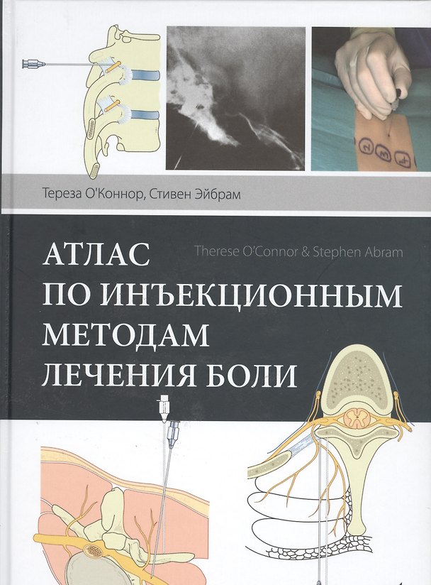 Книга Атлас по инъекционным методам лечения боли (Тереза К. О`Коннор) — 1