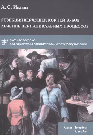 Резекция верхушек корней зубов - лечение периапикальных процессов — 2891646 — 1