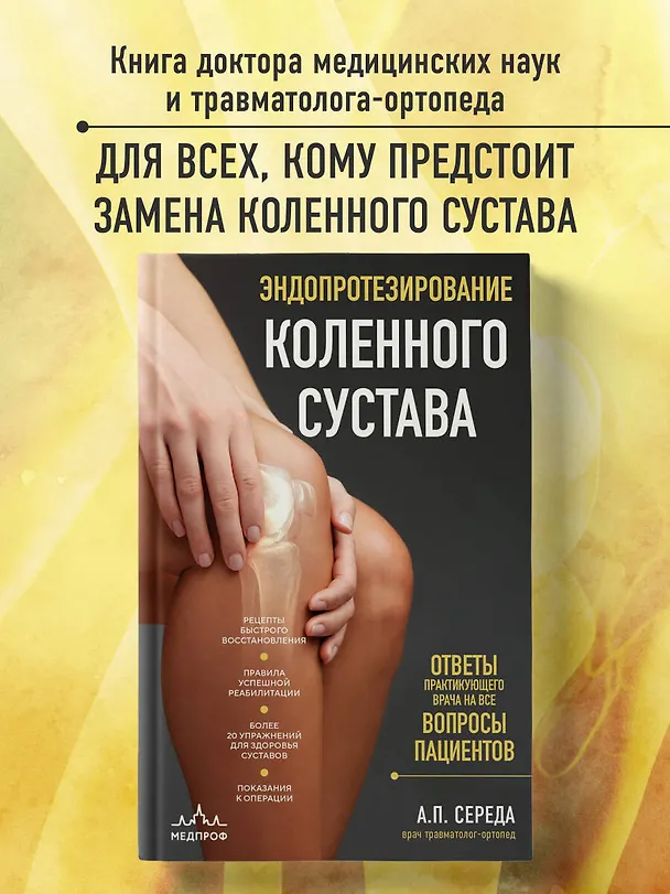 Книга Эндопротезирование коленного сустава: ответы практикующего врача на все вопросы пациентов (Андрей Середа) — 5