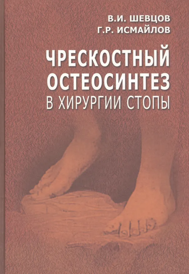 Книга Чрескостный остеосинтез в хирургии стопы. Руководство для врачей (Георгий Шевцов) — 1