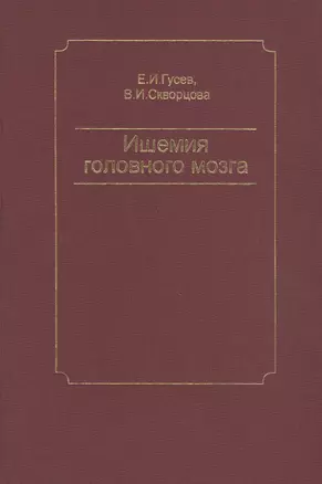 Ишемия головного мозга — 2791642 — 1