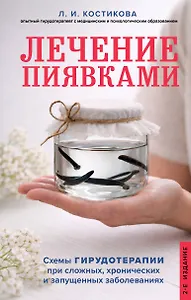 Лечение пиявками. Схемы гирудотерапии при сложных, хронических и запущенных заболеваниях
