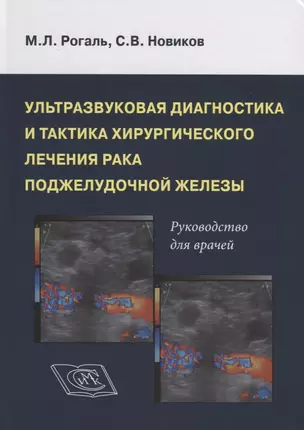 Ультрозвуковая диагностика и тактика хирургического лечения рака поджелудочной железы. Руководство для врачей — 2762857 — 1