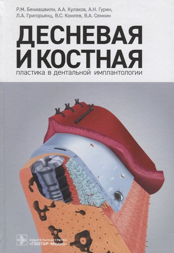Книга Десневая и костная пластика в дентальной имплантологии. () — 1