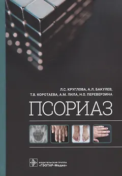 Псориаз