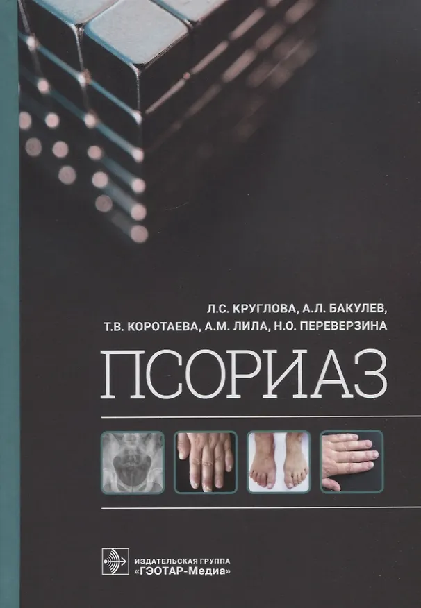 Книга Псориаз (Бакулев Андрей Леонидович, Лариса Круглова, Татьяна Коротаева) — 1