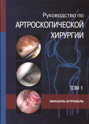 Руководство по артроскопической хирургии. В 2-х томах. Т.1 — 2525420 — 1