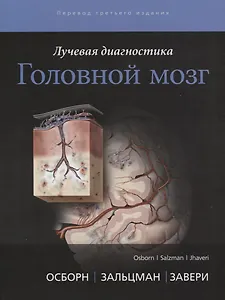 Лучевая диагностика. Головной мозг