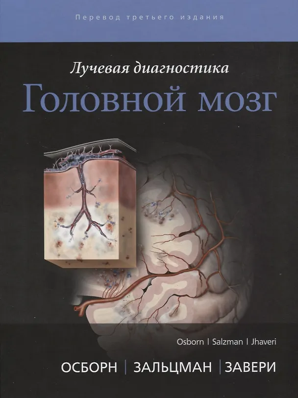 Книга Лучевая диагностика. Головной мозг (А. Осборн) — 1