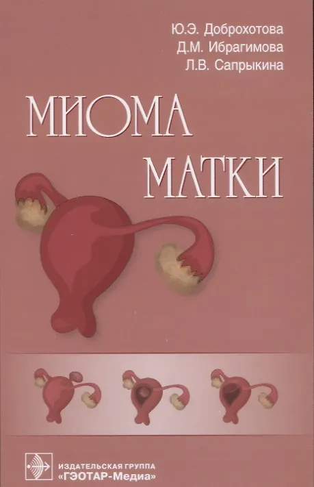 Книга Миома матки (Юлия Доброхотова, Джамиля Ибрагимова, Людмила Сапрыкина) — 1